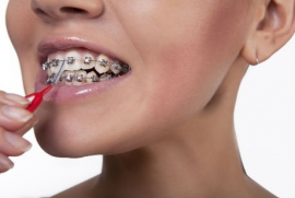 ортодонт стоматология